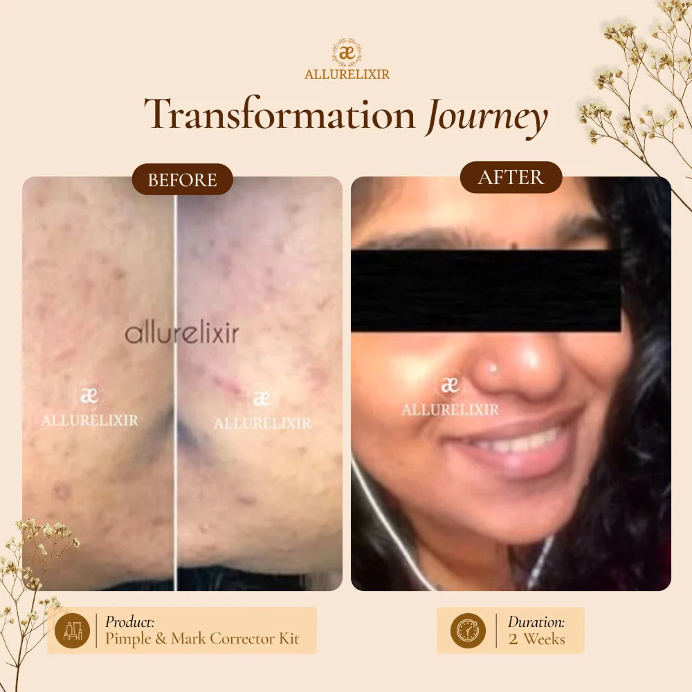 Brightening & Pimple Care Duo