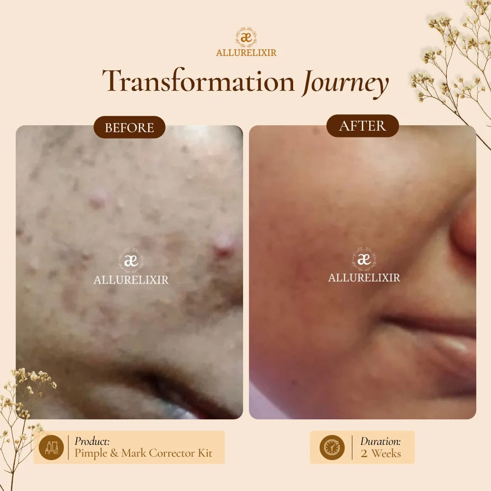 Varnyah : Soap Free Face Wash ( Brightening + Anti Acne )