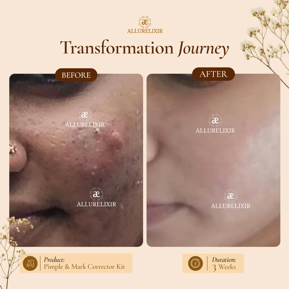 Brightening & Pimple Care Duo