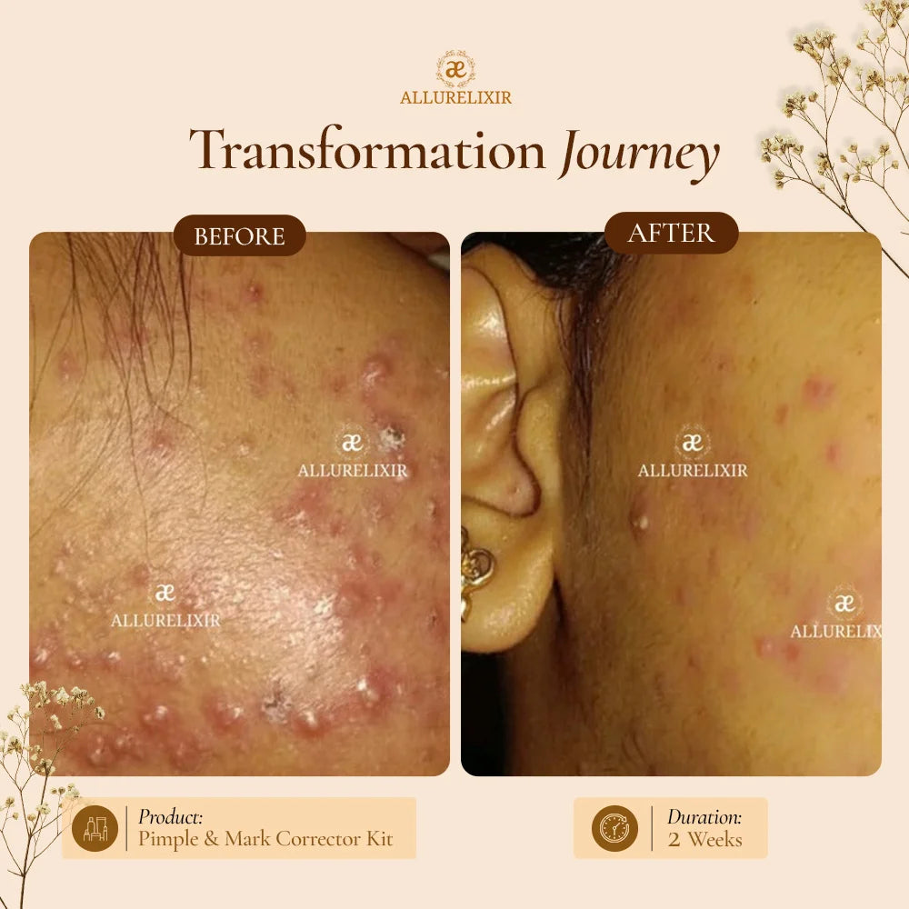 Brightening & Pimple Care Duo