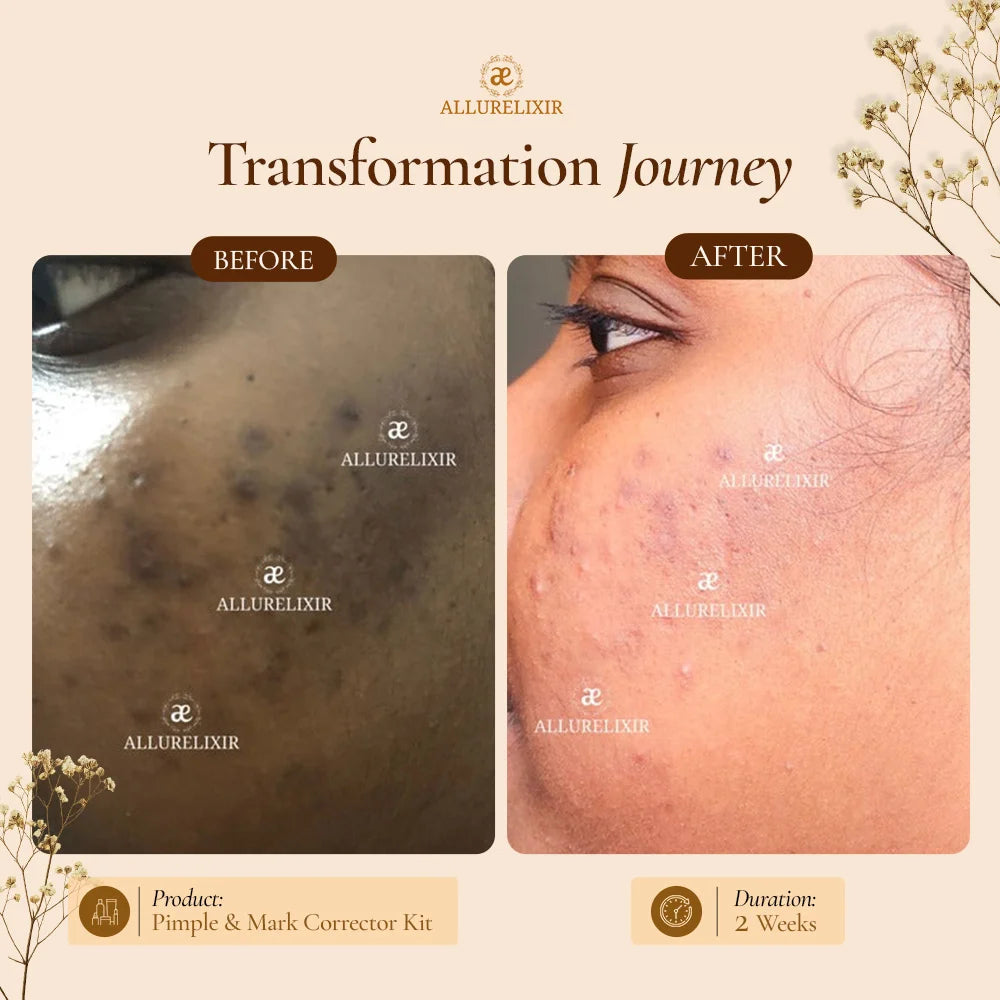 Brightening & Pimple Care Duo