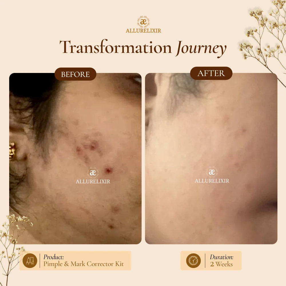 Brightening & Pimple Care Duo