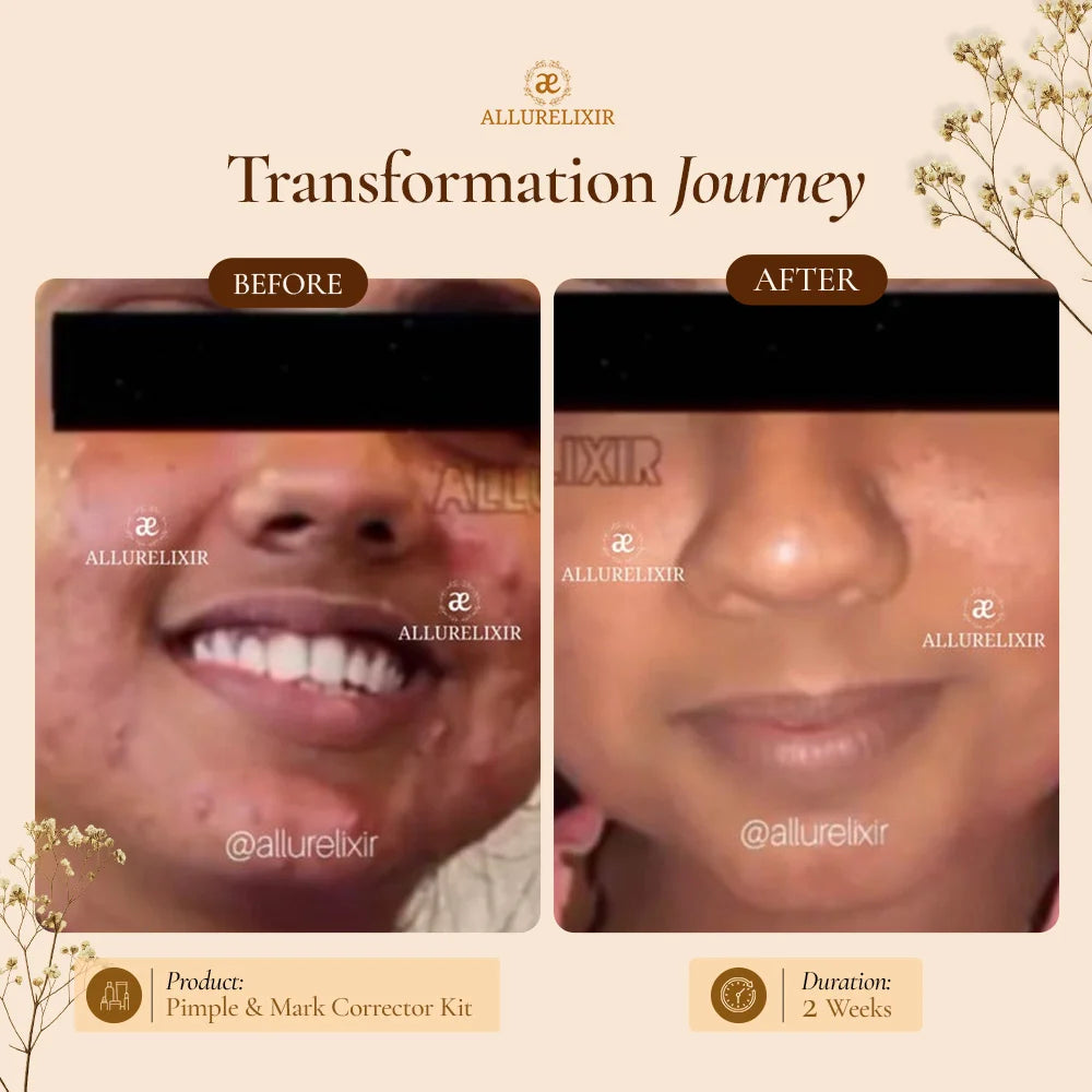 Brightening & Pimple Care Duo