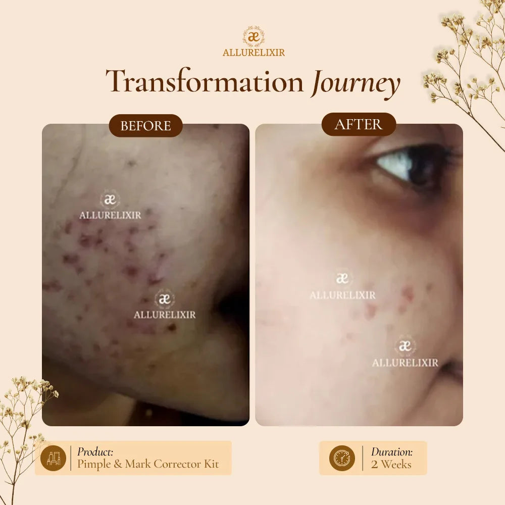 Varnyah : Soap Free Face Wash ( Brightening + Anti Acne )