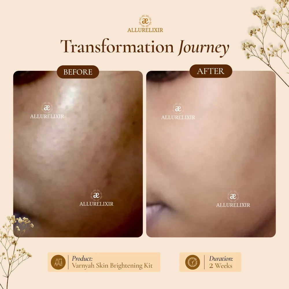 Varnyah : Soap Free Face Wash ( Brightening + Anti Acne )