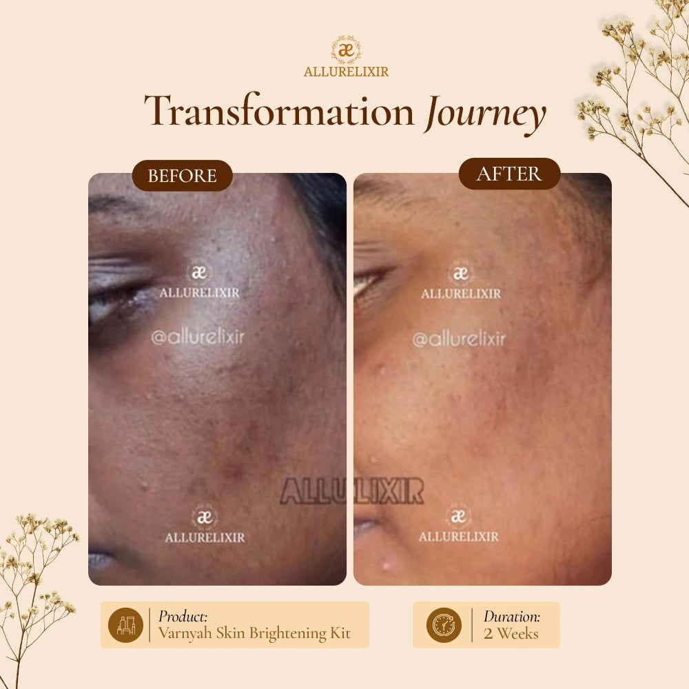 Varnyah : Skin Brightening Pack