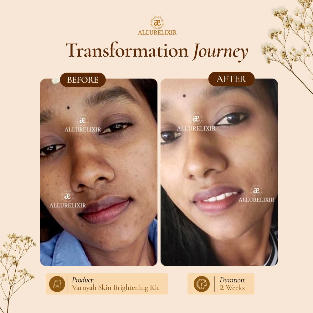 Varnyah : Soap Free Face Wash ( Brightening + Anti Acne )