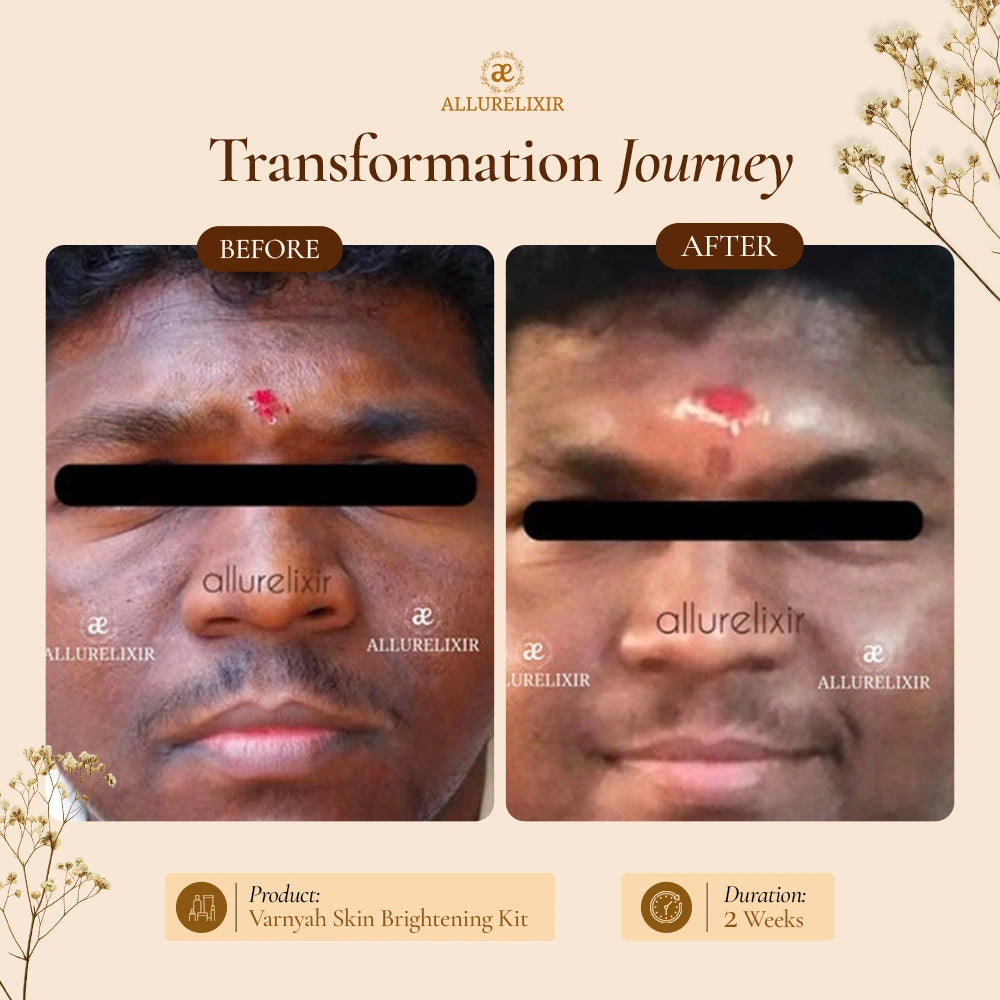 Varnyah : Soap Free Face Wash ( Brightening + Anti Acne )