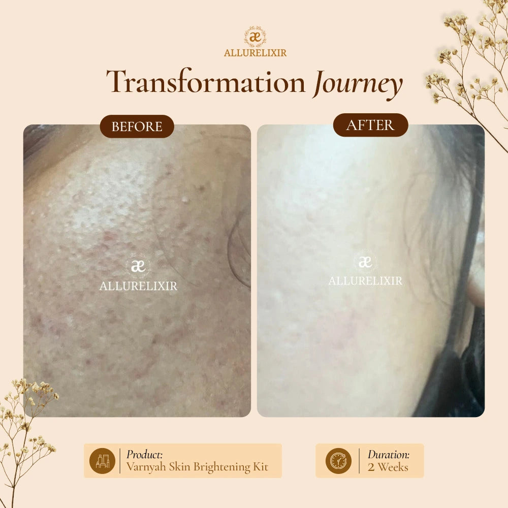 Varnyah : Skin Brightening Pack