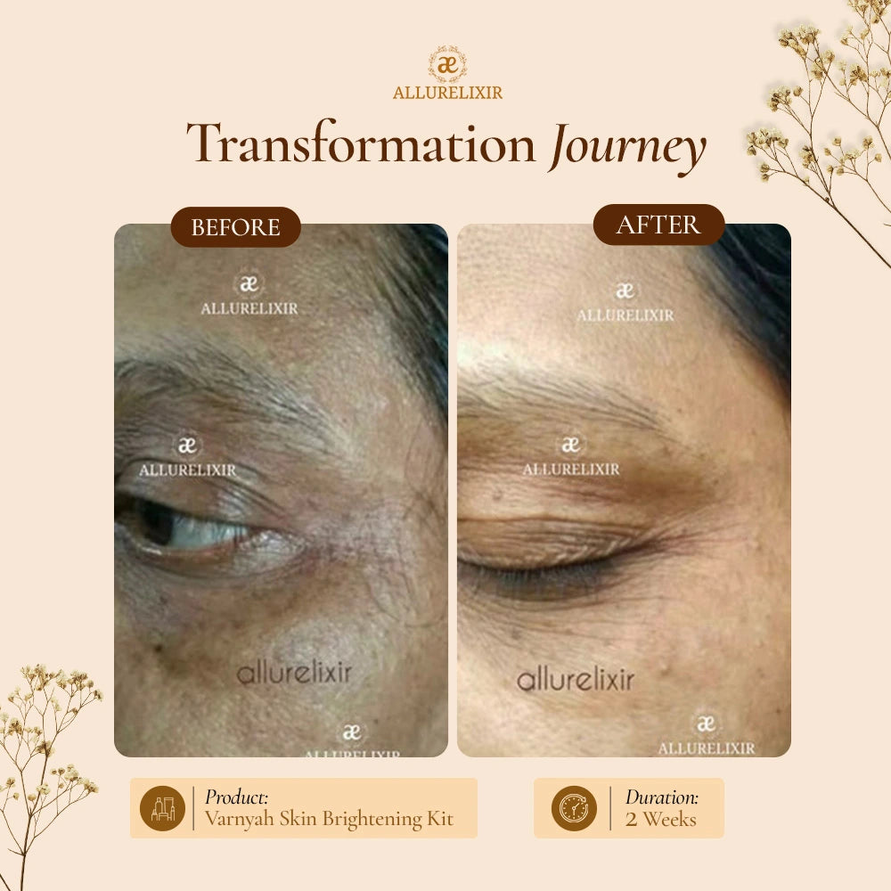 Varnyah : Face Brightening Duo