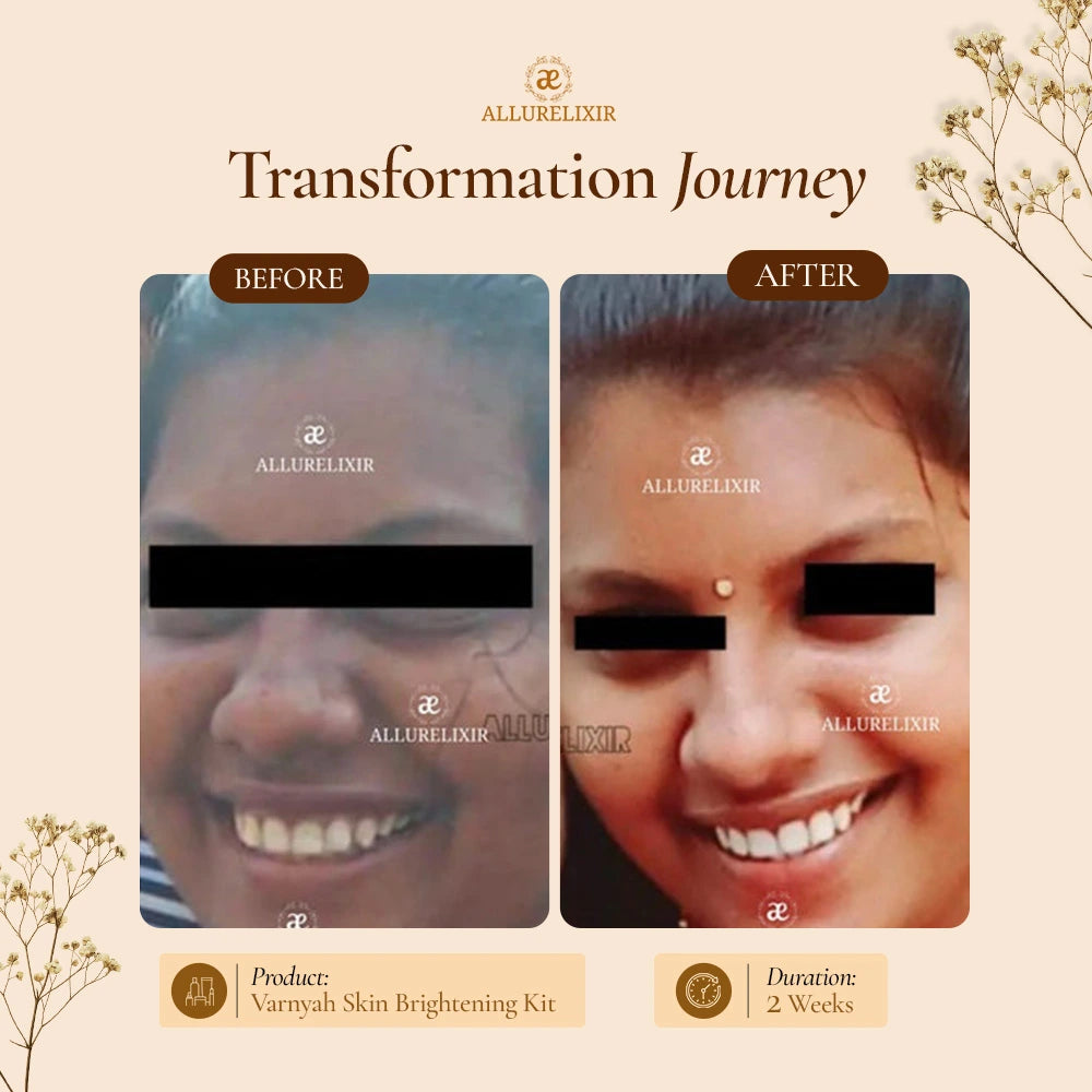 Varnyah : Face Brightening Duo