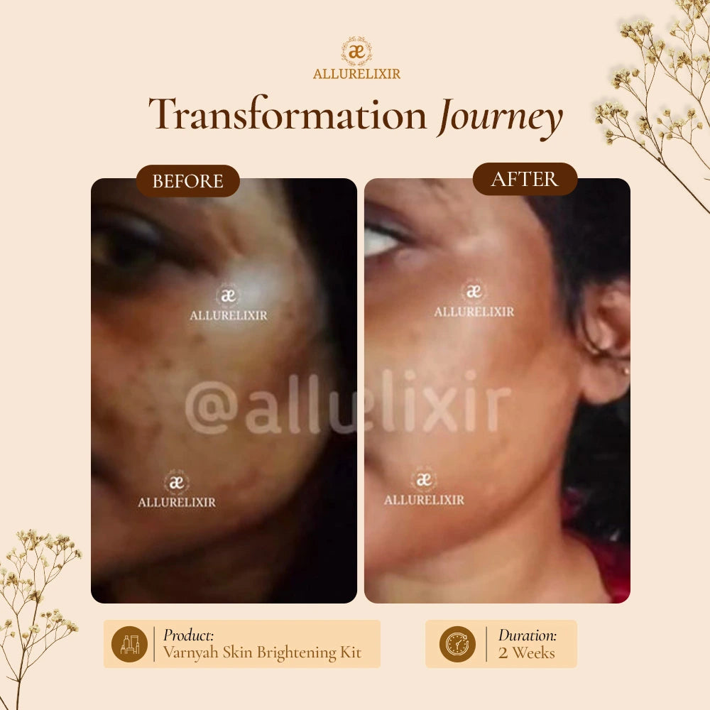 Varnyah : Face Brightening Duo