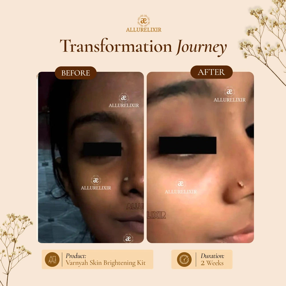 Varnyah : Face Brightening Duo