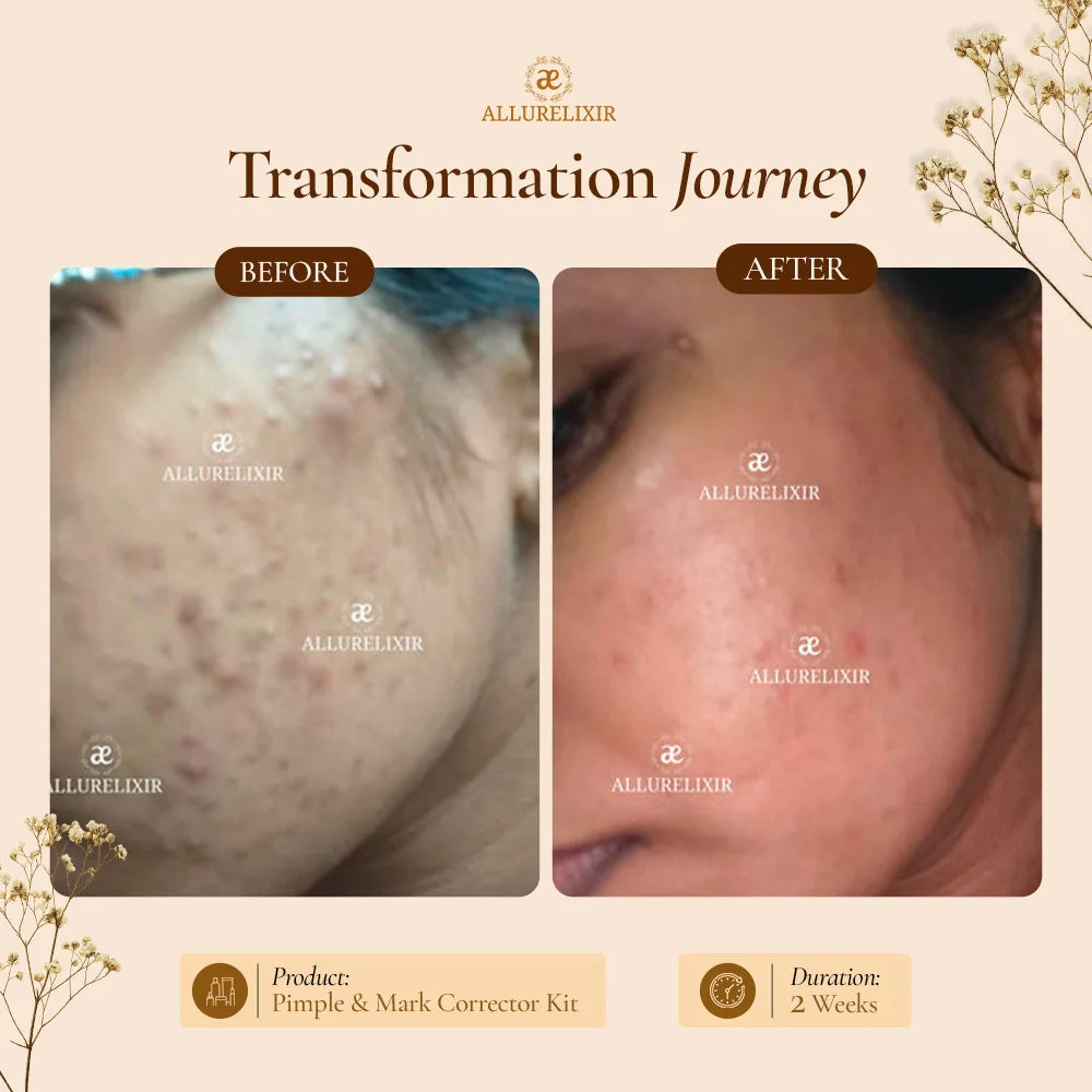 Varnyah : Soap Free Face Wash ( Brightening + Anti Acne )