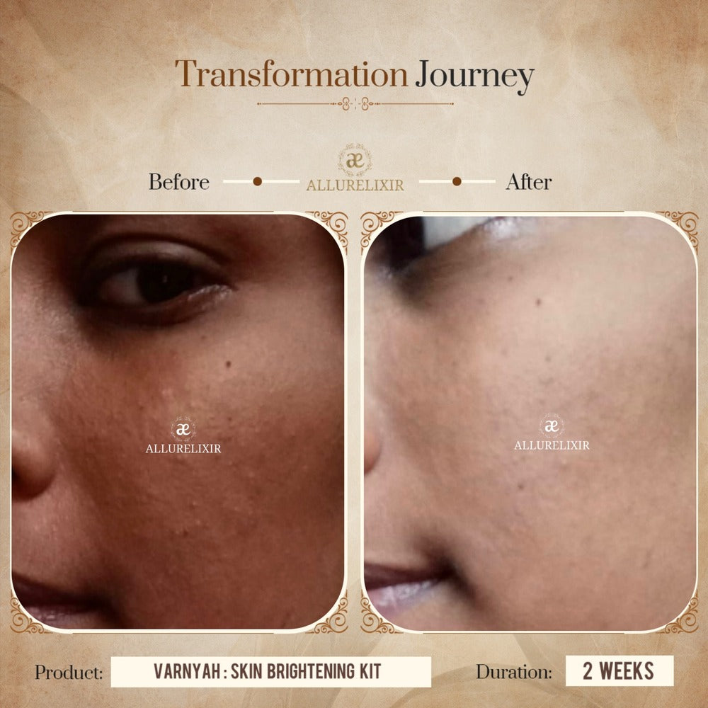 Varnyah: 6 in 1 Brightening Kit ( Pack + Face oil + Lip balm + Face cleanser + Body oil + Body Lotion )